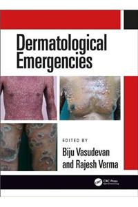 Dermatological Emergencies