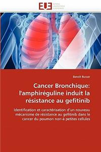 Cancer Bronchique