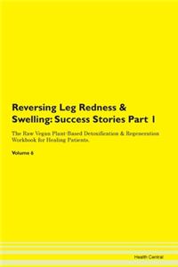 Reversing Leg Redness & Swelling: Succes