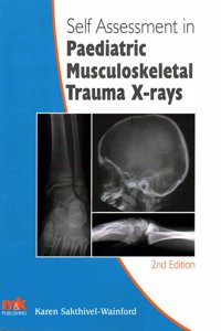 Self-Assessment in Paediatric Musculoskeletal Trauma X-Rays