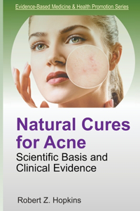 Natural Cures for Acne