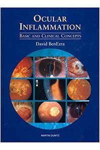 Ocular Inflammation: Clinical and basic concepts