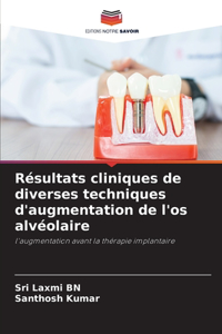 Résultats cliniques de diverses techniques d'augmentation de l'os alvéolaire