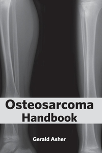 Osteosarcoma Handbook