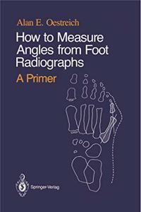 How to Measure Angles from Foot Radiographs