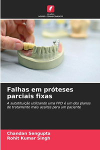 Falhas em próteses parciais fixas