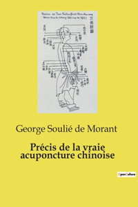 Précis de la vraie acuponcture chinoise