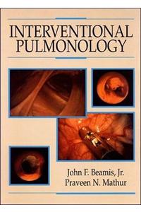 Interventional Pulmonology