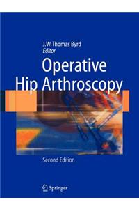 Operative Hip Arthroscopy