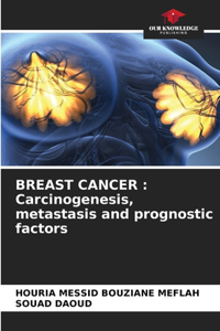 Breast Cancer