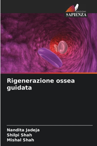 Rigenerazione ossea guidata