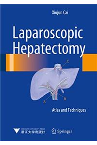 Laparoscopic Hepatectomy