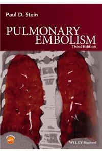 Pulmonary Embolism