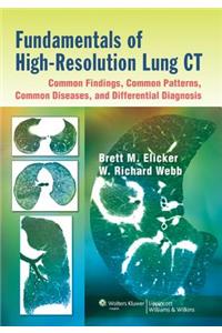 Fundamentals of High-Resolution Lung Ct: Common Findings, Common Patterns, Common Diseases, and Differential Diagnosis: Common Findings, Common Patterns, Common Diseases, and Differential Diagnosis