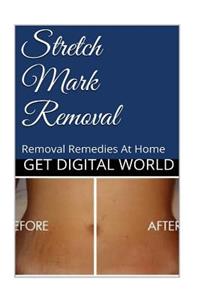 Stretch Mark Removal: Removal Remedies at Home