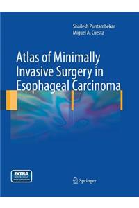 Atlas of Minimally Invasive Surgery in Esophageal Carcinoma