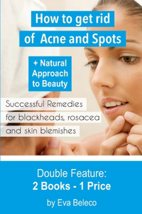 How to Get Rid of Acne and Spots + The natural Approach to Beauty