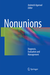 Nonunions