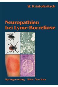 Neuropathien Bei Lyme-Borreliose