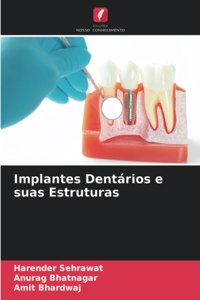 Implantes Dentários e suas Estruturas