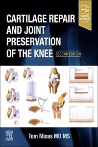 Cartilage Repair and Joint Preservation of the Knee