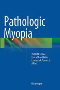 Pathologic Myopia