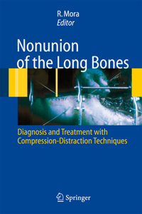 Nonunion of the Long Bones