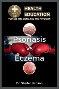 Psoriasis vs. Eczema