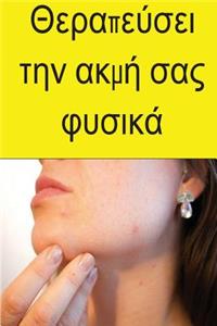 Cure Your Acne Naturally (Greek)