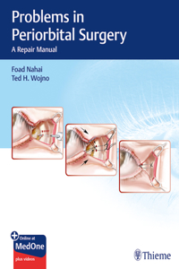 Problems in Periorbital Surgery