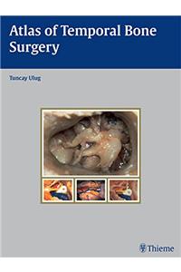 Atlas of Temporal Bone Surgery