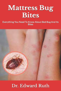 Mattress Bug Bites