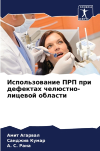 Использование ПРП при дефектах челюстно-л