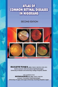 Atlas of Retinal Diseases in Nigerians