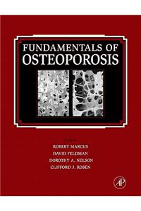 Fundamentals of Osteoporosis
