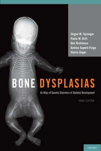 Bone Dysplasias: An Atlas of Genetic Disorders of Skeletal Development