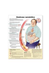 Metabolic Syndrome Anatomical Chart in Spanish (Síndrome metabólico)