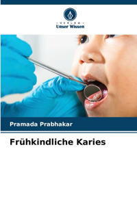 Frühkindliche Karies