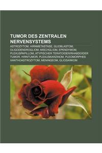 Tumor Des Zentralen Nervensystems