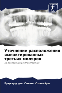 Уточнение расположения импактированных &