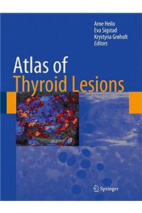 Atlas of Thyroid Lesions