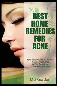 Best Home Remedies For Acne
