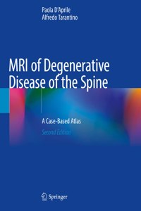 MRI of Degenerative Disease of the Spine