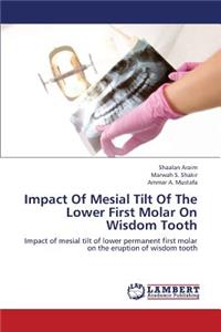 Impact of Mesial Tilt of the Lower First Molar on Wisdom Tooth