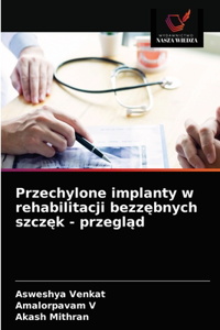 Przechylone implanty w rehabilitacji bezzębnych szczęk - przegląd