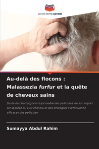 Au-delà des flocons