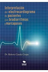 Interpretación del electrocardiograma de pacientes con bradiarritmias y marcapasos