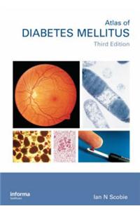 An Atlas of Diabetes Mellitus, Second Edition