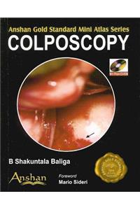 Mini Atlas of Colposcopy