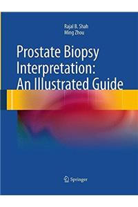 Prostate Biopsy Interpretation